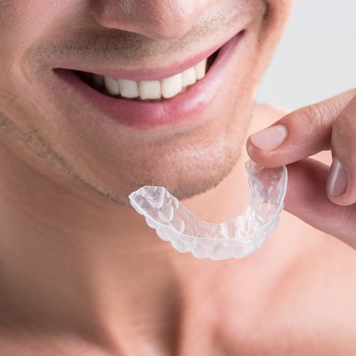 Close up shot of a man smiling holding his clear aligners 